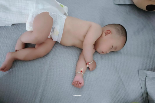 秦皇岛六个月宝宝眼睛散光